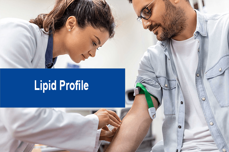 lipid profile test-min