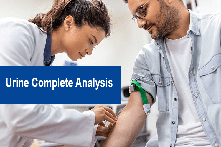 urine complete analysis-min