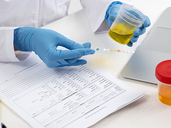 Blood & Urine Analysis